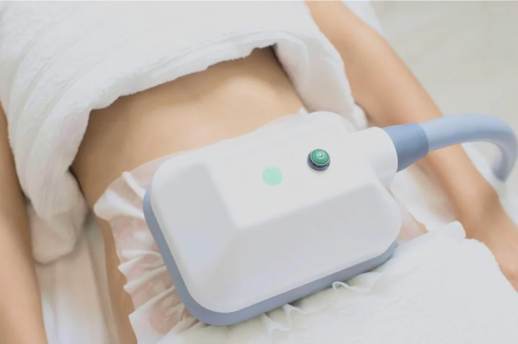 How Fat Freezing and HIFU Work Together? 3 advantages to combining Fat Freezing and HIFU Hastings