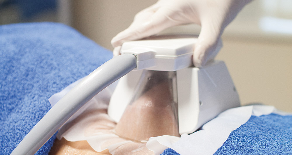 How Fat Freezing and HIFU Work Together? 2 Multiple Areas in One Session HIFU and Fat Freezing Hastings