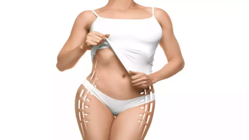Transforming Bodies: Celebrity Success Stories and the Truth Behind Body Contouring