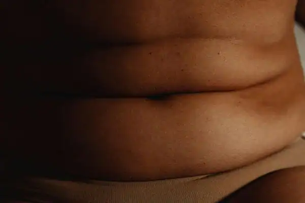 The Hidden Connection: How Stress Shapes Your Fitness and Body Composition 3 image of what stress can do on the stomach area and how Lipo 360 Hastings can help to change your body shape.
